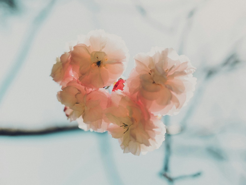 ‘My journey with vulva anxiety: Why I chose not to get labiaplasty’